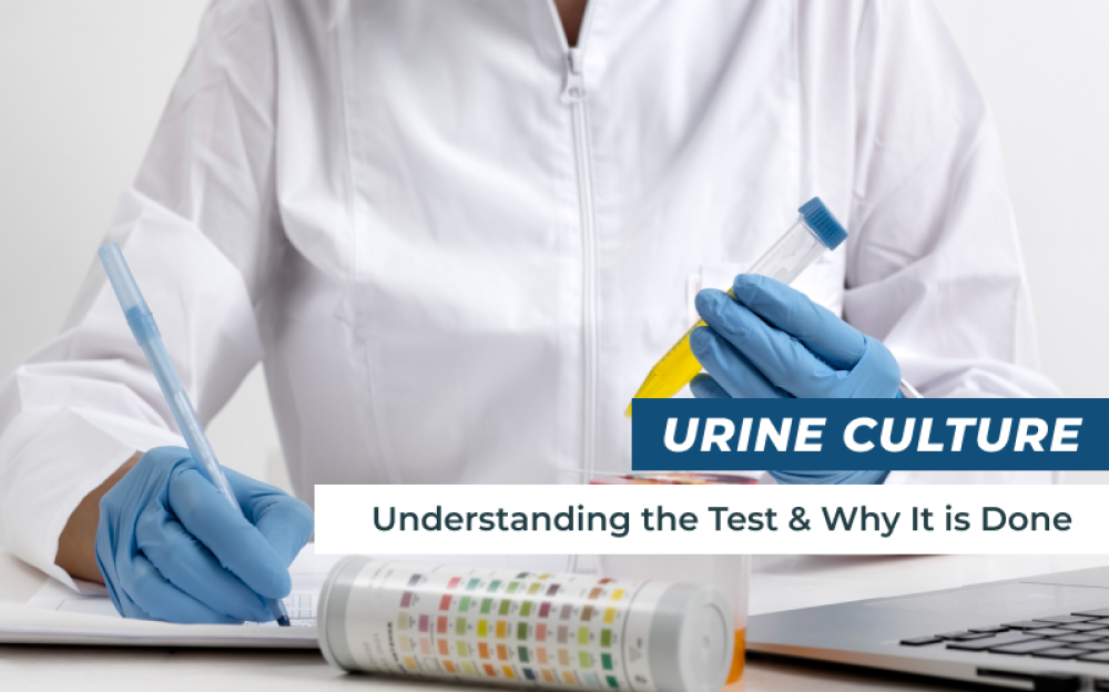 Urine Culture: Understanding the Test and Why it's Done